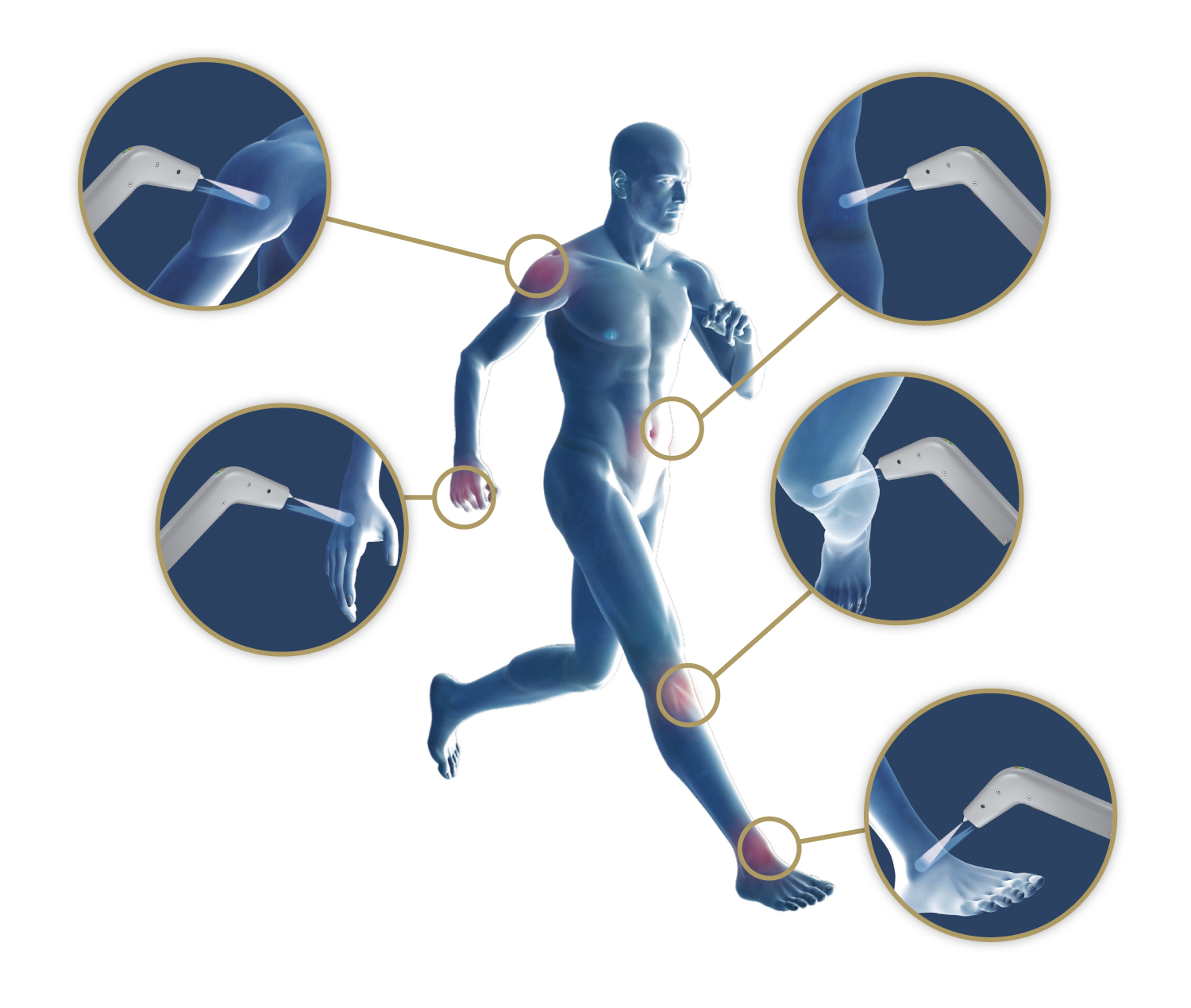 Schmerzzonen Schmerzzonen